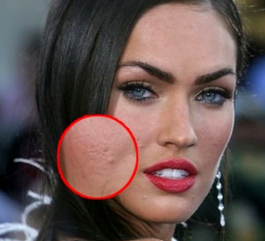 Megan Fox Self Harm Scars